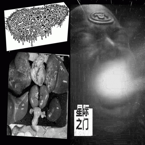 Fetal Deformity : Fetal Deformity - Chappa'ai